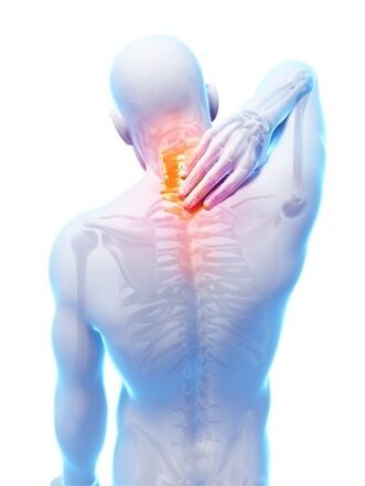 Osteocondrosis espinal, en la que Hondrocream es indispensable