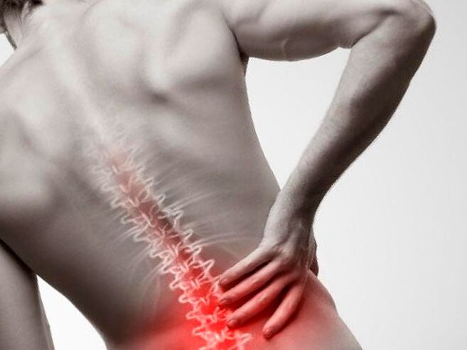 dolor lumbar debido a la osteocondrosis
