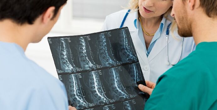 Radiografía de columna como forma de diagnosticar la osteocondrosis. 