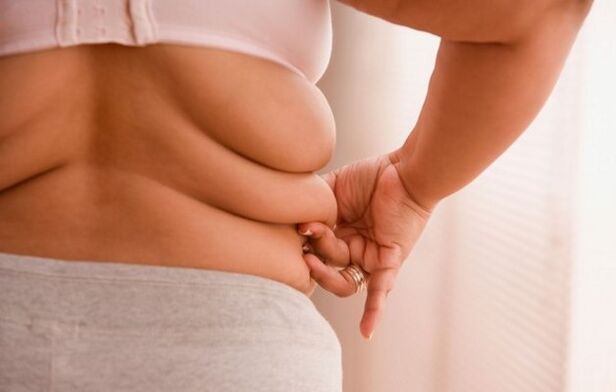 sobrepeso, la causa de la osteocondrosis cervical en mujeres menores de 40 años